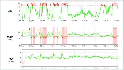 Par&acirc;metros de tend&ecirc;ncia